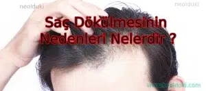 Saç Dökülmesinin  Nedenleri Nelerdir ?