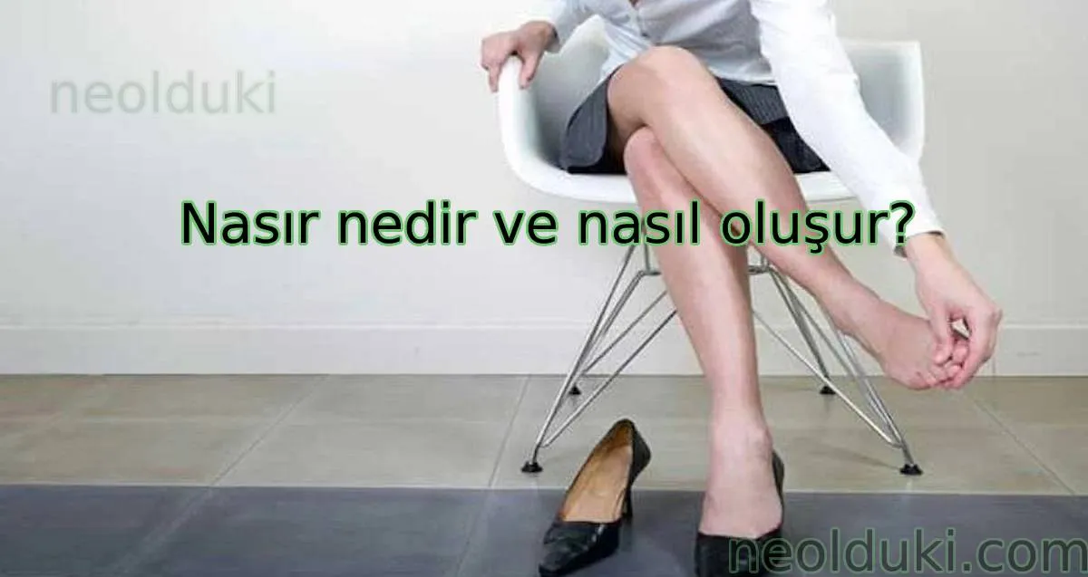 Nasır nedir ve nasıl oluşur?